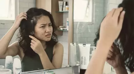 Rambut Rontok: Mengapa Akar Rambut yang Kuat Berawal dari Usus Bersih dan Pikiran Tenang